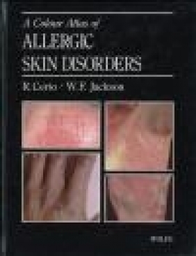 Color Atlas of Allergic Skin Disorders Rino Cerio, William Jackson, W Jackson