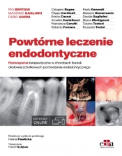 Powtórne leczenie endodontyczne - Bertani P.