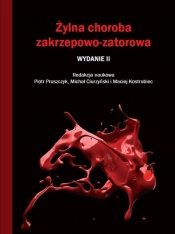Żylna choroba zakrzepowo-zatorowa - Pruszczyk Piotr, Ciurzyński Michał, Kostrubiec Maciej