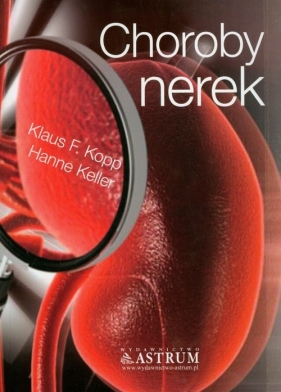 Choroby nerek - Kopp F. Kopp. Keller Hanne