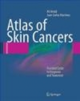 Atlas of Skin Cancers Juan Carlos Martinez, Ali Hendi