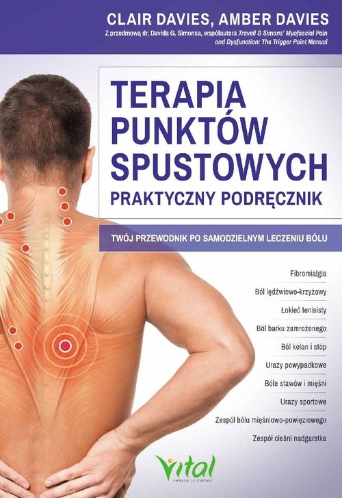 Terapia punktów spustowych