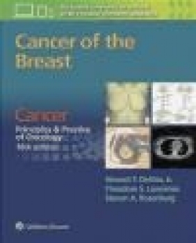 Cancer of the Breast