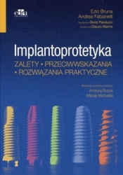 Implantoprotetyka - Ezio Bruna, Andrea Fabianelli
