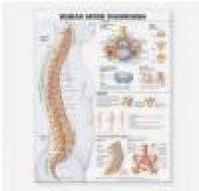 Human Spine Disorders Anatomical Chart Anatomical Chart Company